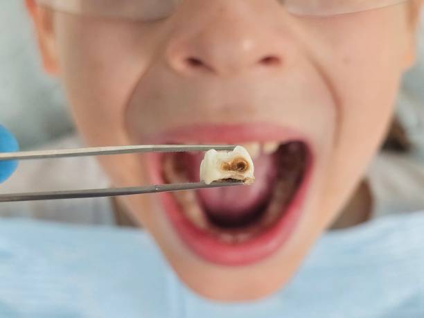 Best Weekend Emergency Dentist in Tolono, IL
